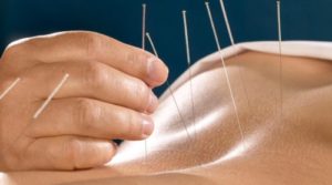 tratamentul acupuncturii prostatitei